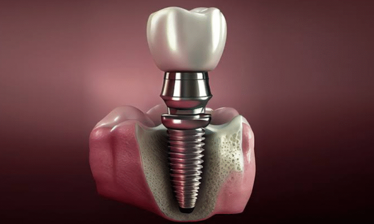 Why Restorative Dentistry Matters Before Advanced Cosmetic Procedures