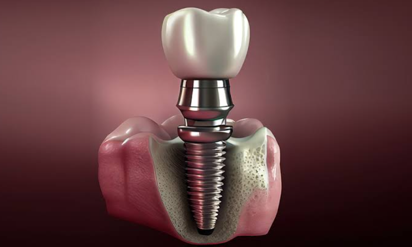 Why Restorative Dentistry Matters Before Advanced Cosmetic Procedures